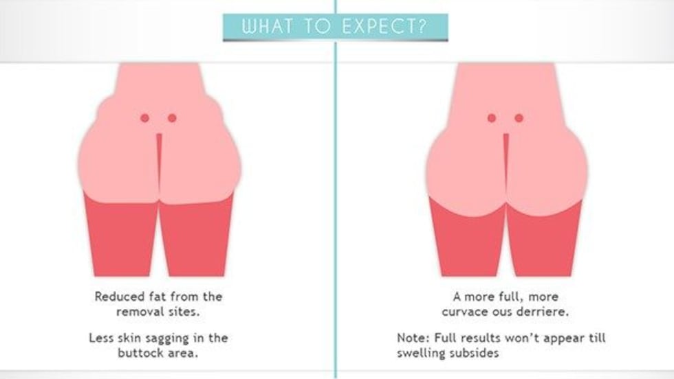 Source: jolieplasticsurgery.com