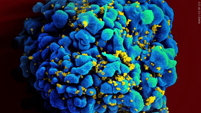 Researchers say this is the third known case of HIV remission in an individual receiving this...